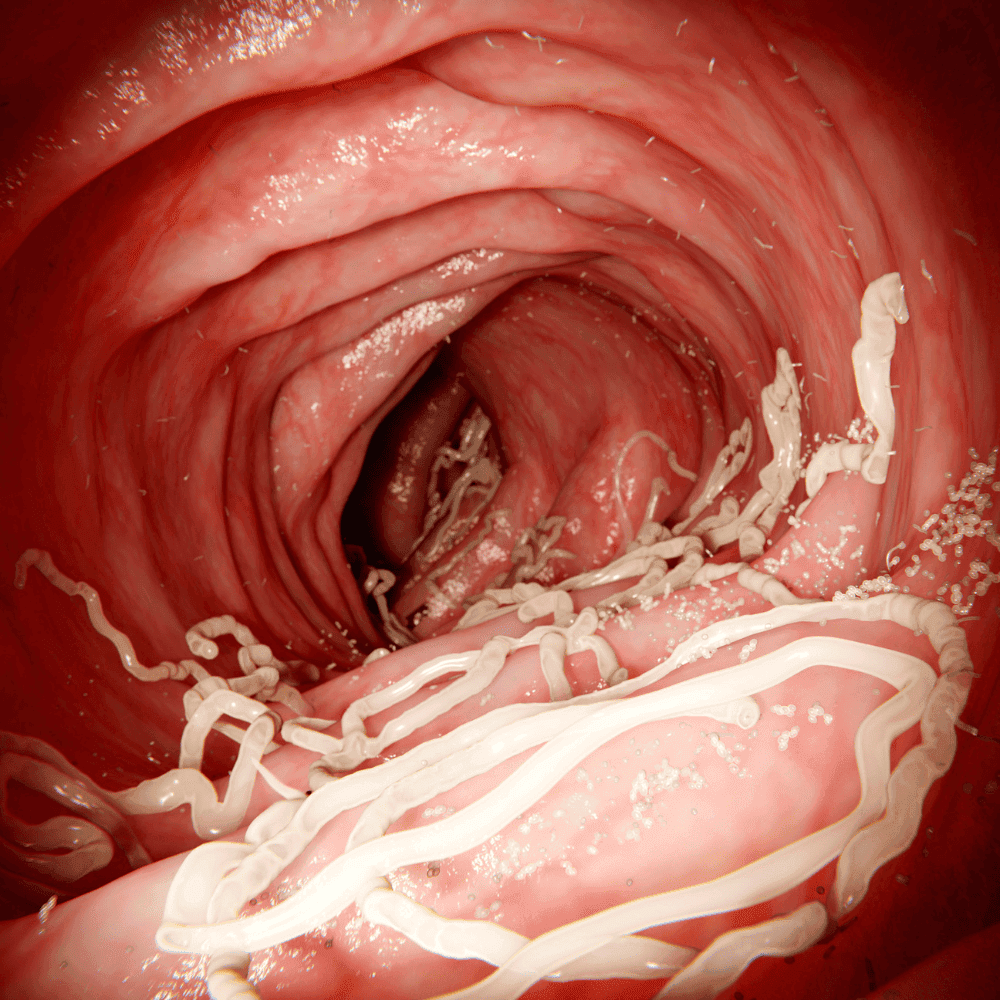 Roundworm